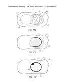 SYSTEM AND METHOD FOR SURGERY diagram and image