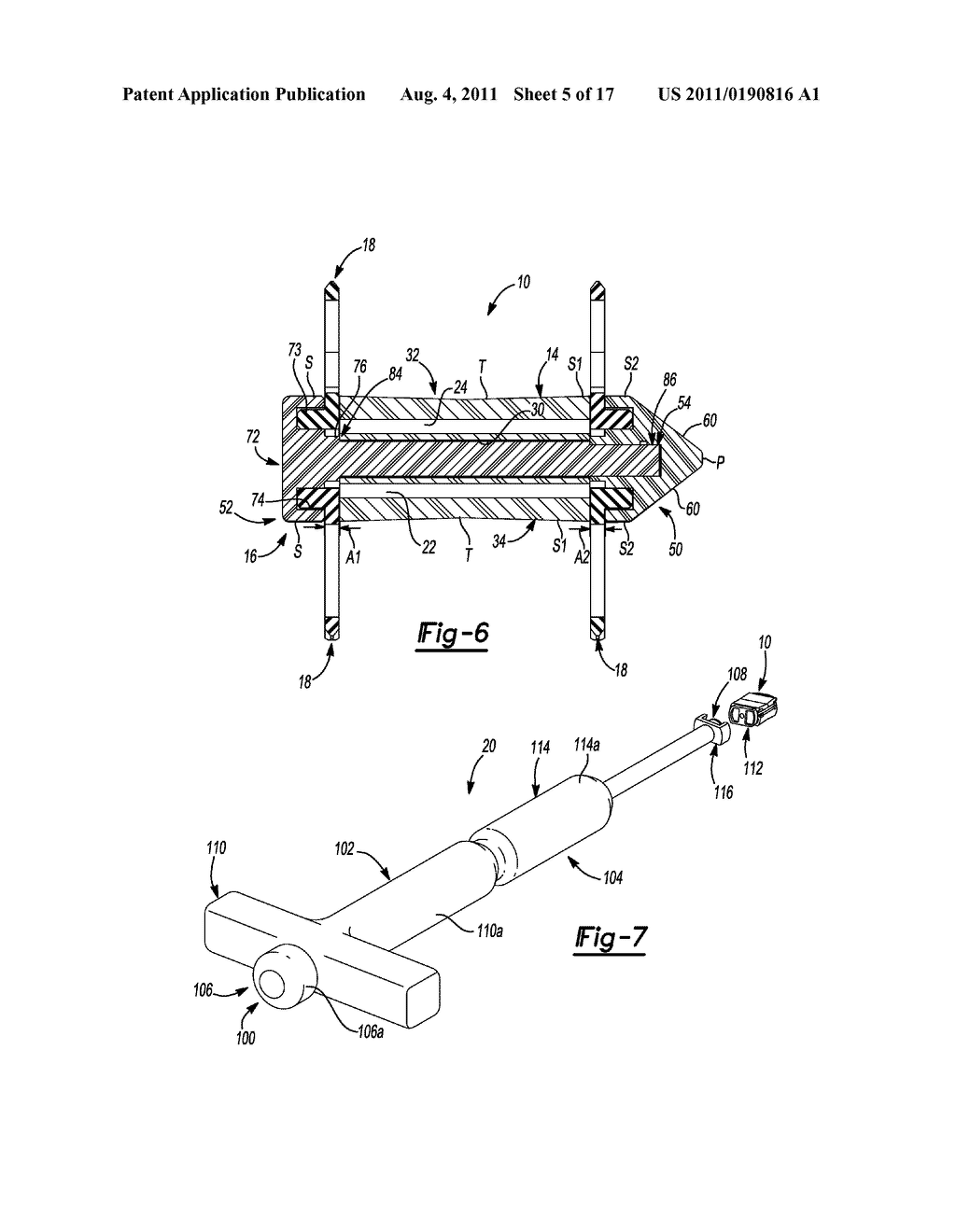 INTERSPINOUS SPACER WITH DEPLOYABLE MEMBERS AND RELATED METHOD - diagram, schematic, and image 06