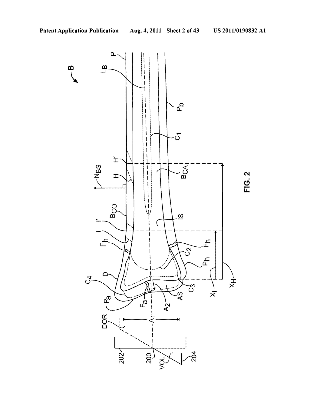 APPARATUS AND METHODS FOR BONE ACCESS AND CAVITY PREPARATION - diagram, schematic, and image 03