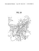 PORTABLE NEGATIVE PRESSURE VENTILATION DEVICE AND METHODS AND SOFTWARE     RELATED THERETO diagram and image