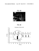 PORTABLE NEGATIVE PRESSURE VENTILATION DEVICE AND METHODS AND SOFTWARE     RELATED THERETO diagram and image