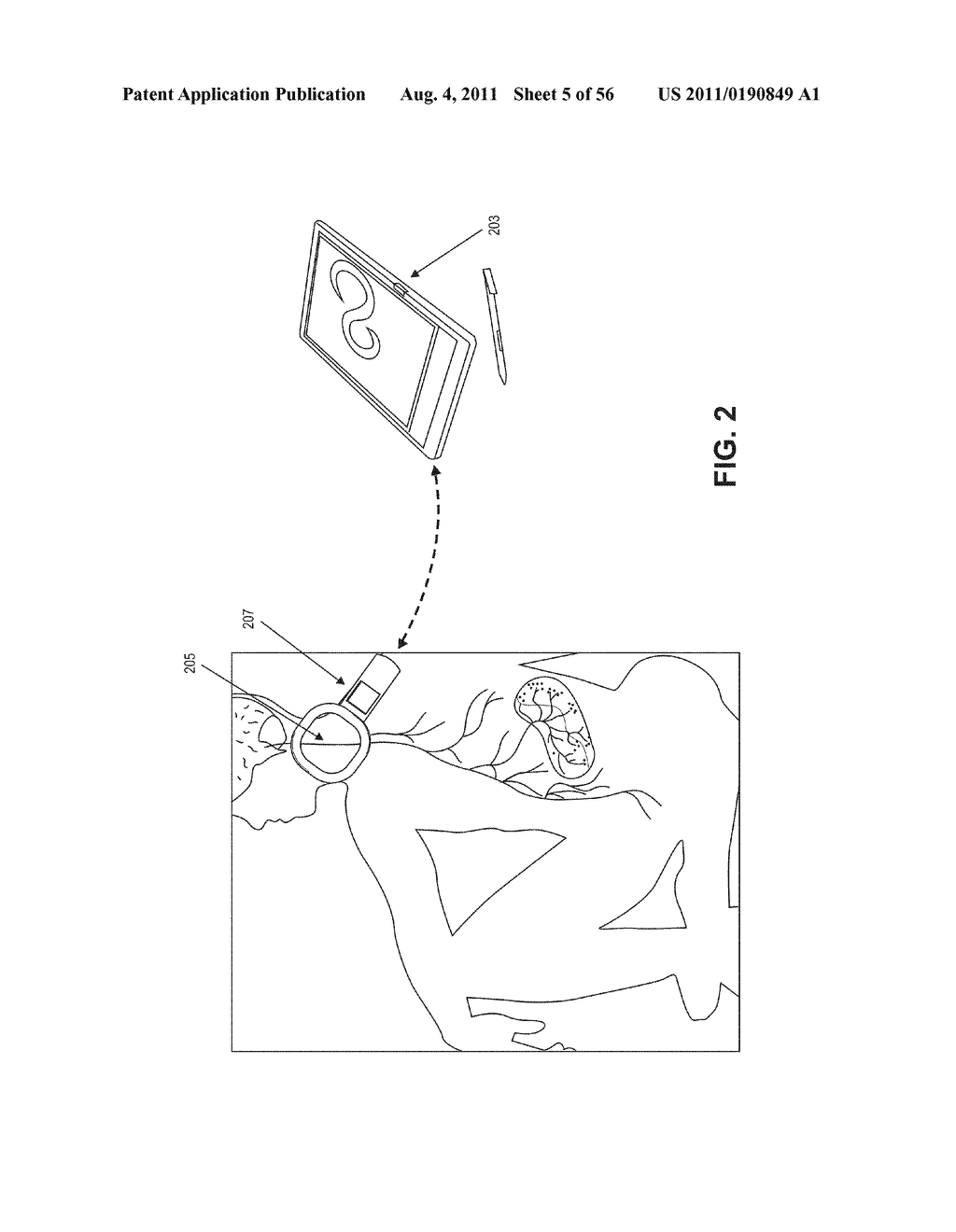 NEURAL STIMULATION DEVICES AND SYSTEMS FOR TREATMENT OF CHRONIC     INFLAMMATION - diagram, schematic, and image 06