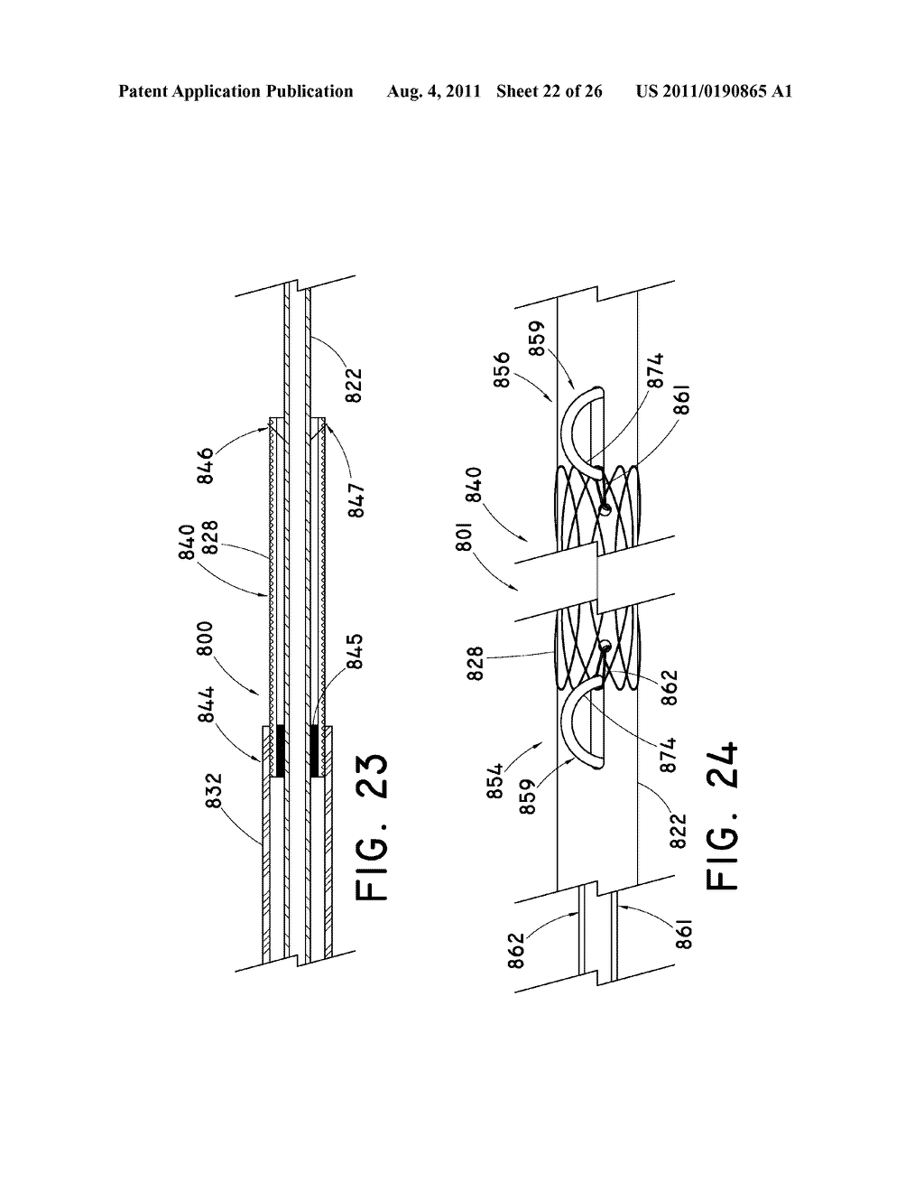 Mechanically Expandable Delivery and Dilation Systems - diagram, schematic, and image 23