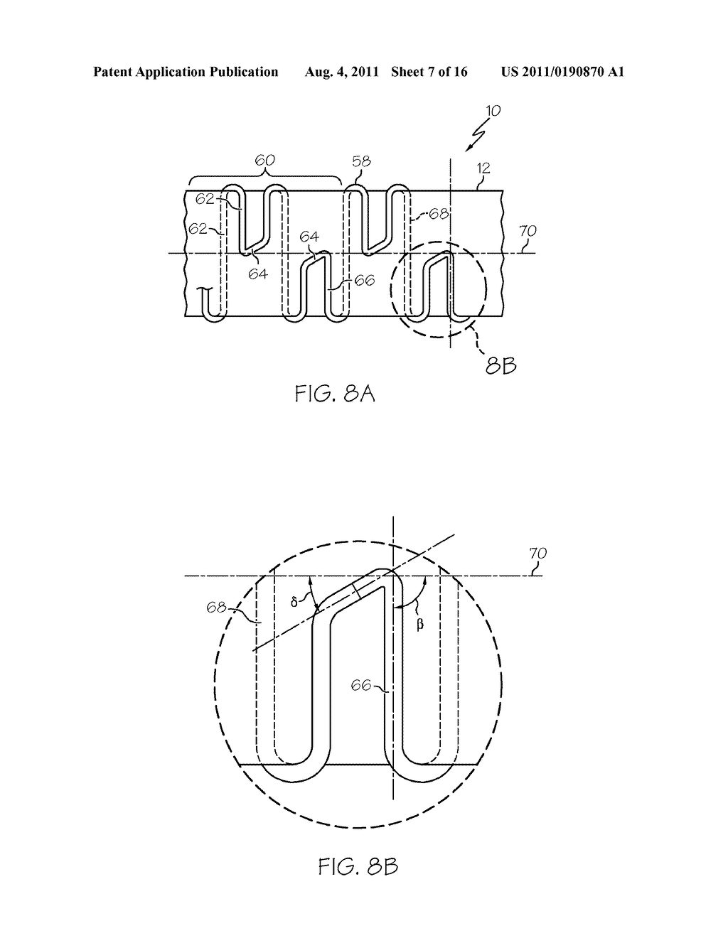 Covered Stent for Vascular Closure - diagram, schematic, and image 08