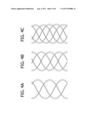 BRAIDED TERTIARY NANOFIBROUS STRUCTURE FOR LIGAMENT, TENDON, AND MUSCLE     TISSUE IMPLANT diagram and image