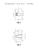 LORDOTIC INTERBODY DEVICE WITH DIFFERENT SIZES RAILS diagram and image