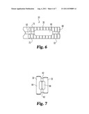 LORDOTIC INTERBODY DEVICE WITH DIFFERENT SIZES RAILS diagram and image