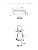 LORDOTIC INTERBODY DEVICE WITH DIFFERENT SIZES RAILS diagram and image