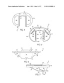 CRUCIATE-RETAINING KNEE PROSTHESIS diagram and image