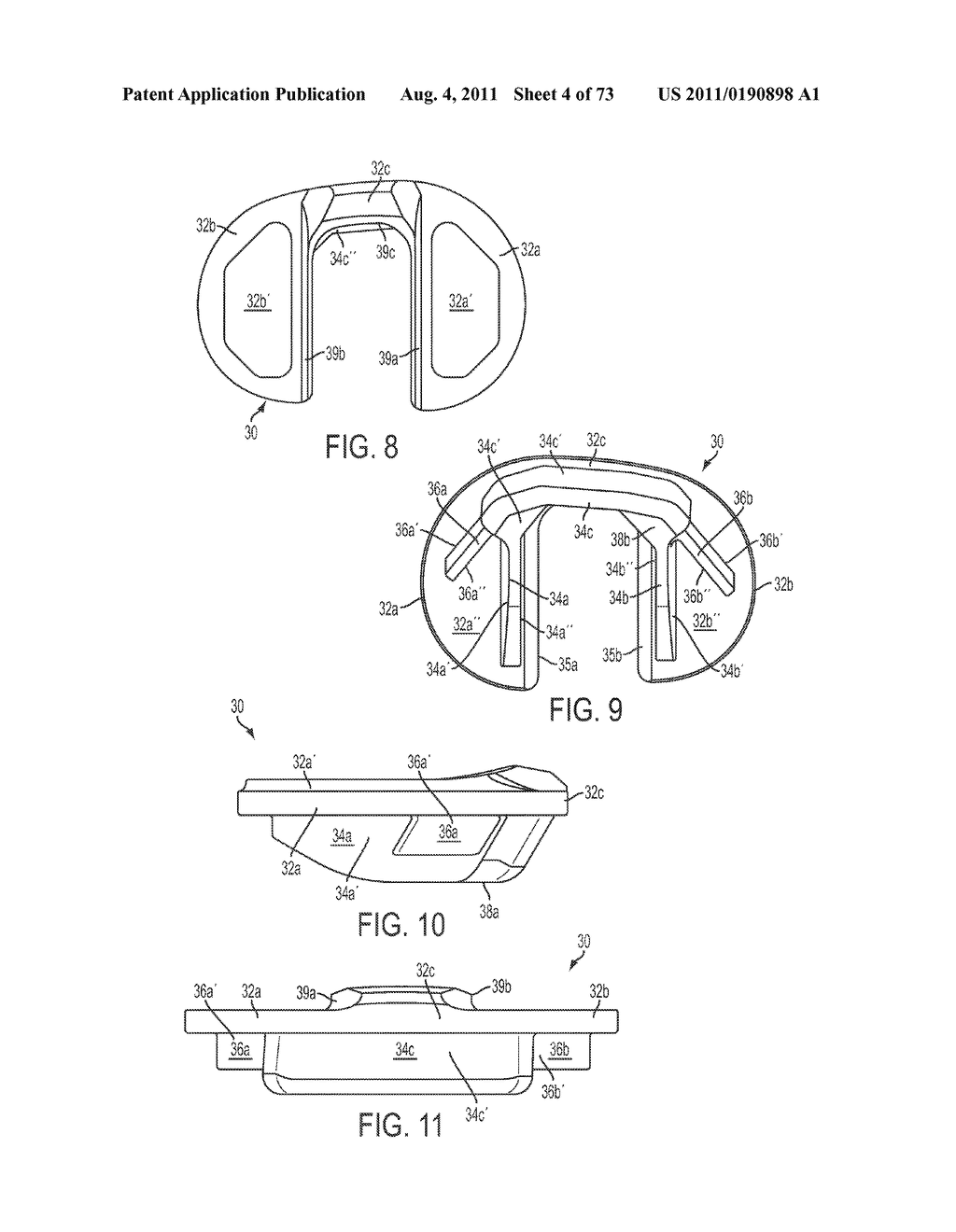 CRUCIATE-RETAINING KNEE PROSTHESIS - diagram, schematic, and image 05