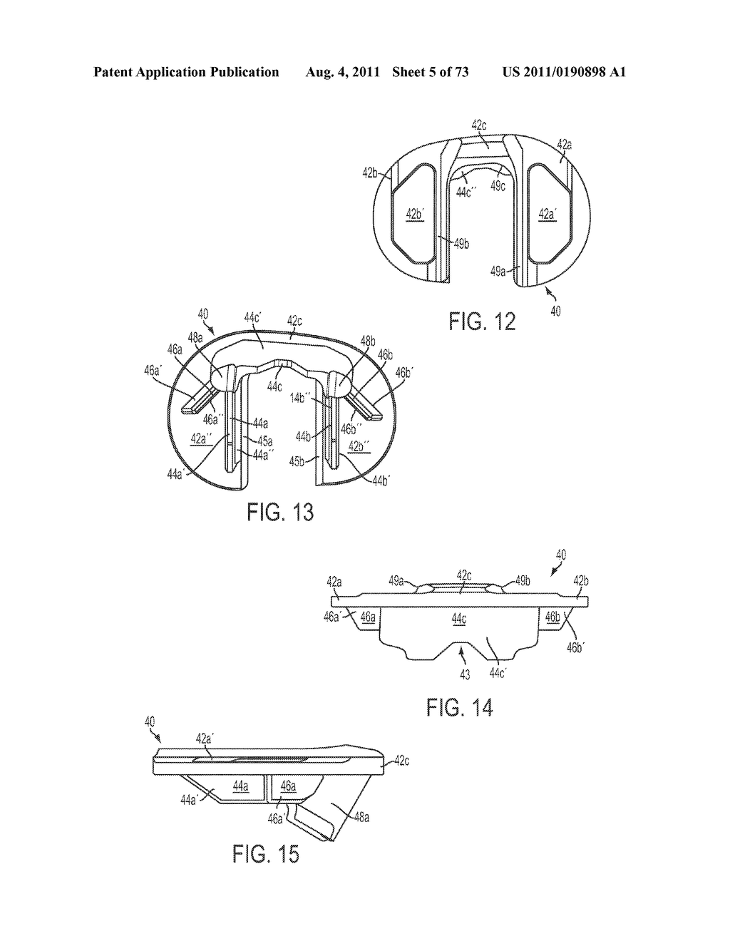 CRUCIATE-RETAINING KNEE PROSTHESIS - diagram, schematic, and image 06