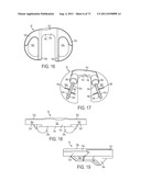 CRUCIATE-RETAINING KNEE PROSTHESIS diagram and image