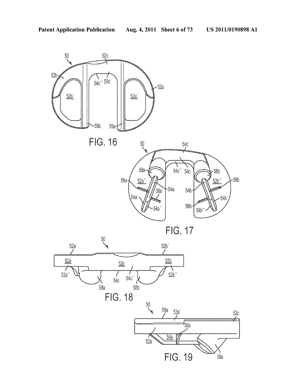 CRUCIATE-RETAINING KNEE PROSTHESIS - diagram, schematic, and image 07