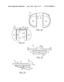 CRUCIATE-RETAINING KNEE PROSTHESIS diagram and image