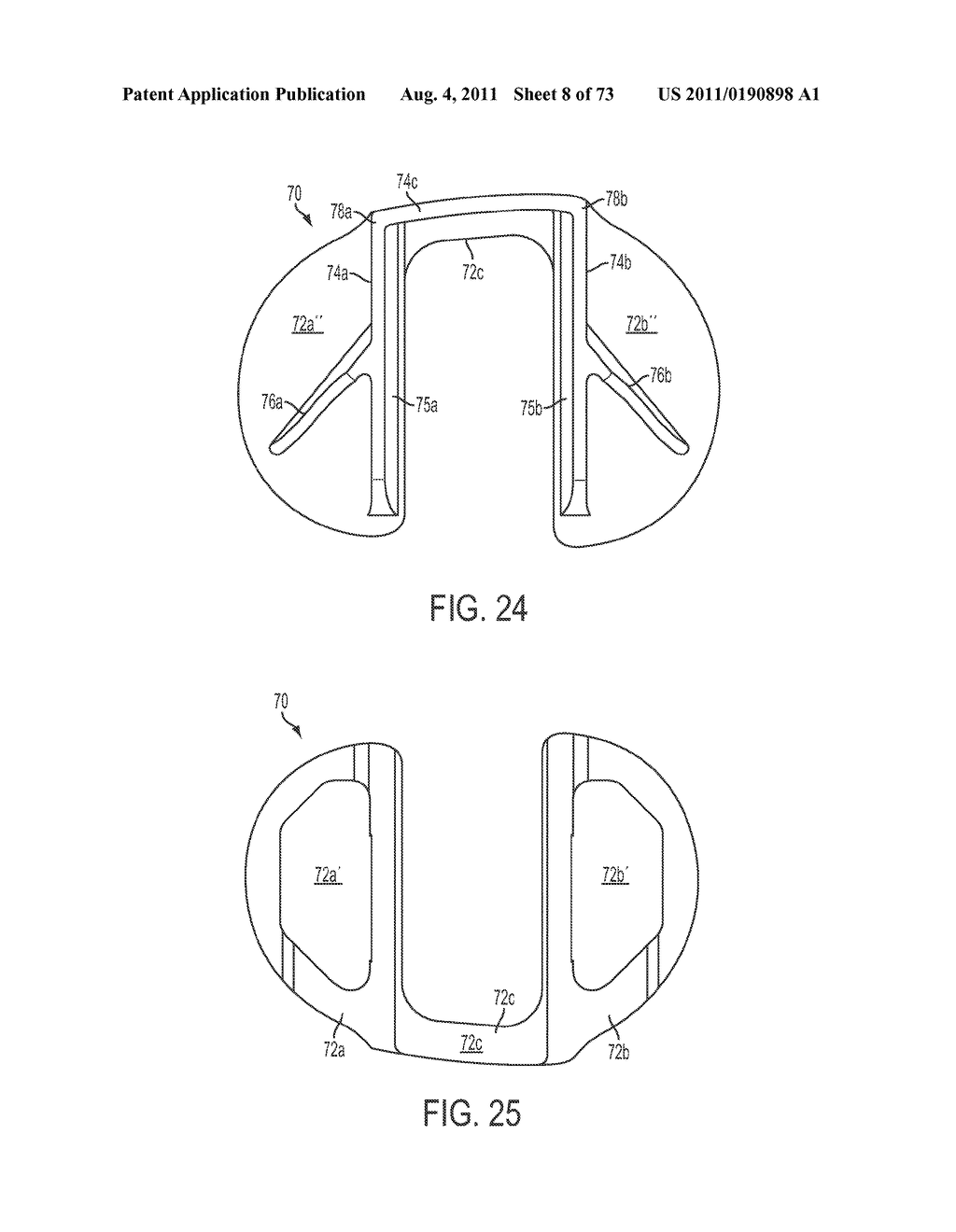 CRUCIATE-RETAINING KNEE PROSTHESIS - diagram, schematic, and image 09