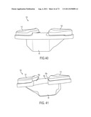 CRUCIATE-RETAINING KNEE PROSTHESIS diagram and image