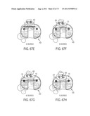 CRUCIATE-RETAINING KNEE PROSTHESIS diagram and image