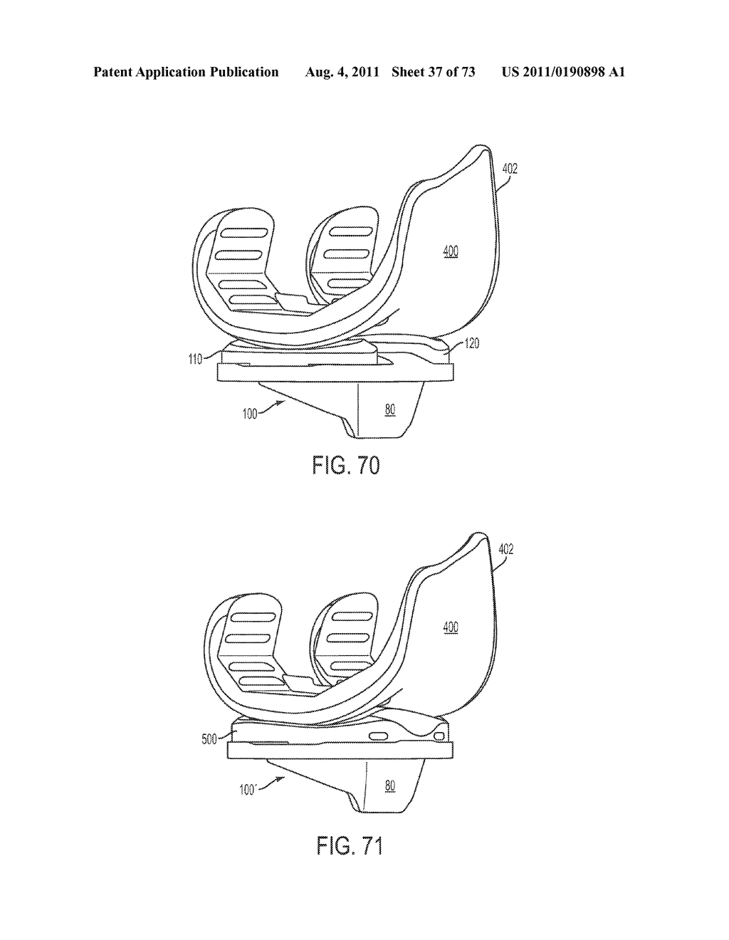 CRUCIATE-RETAINING KNEE PROSTHESIS - diagram, schematic, and image 38