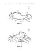 CRUCIATE-RETAINING KNEE PROSTHESIS diagram and image