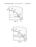 Acetabular Prosthetic Devices and Associated Methods diagram and image