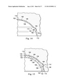 Acetabular Prosthetic Devices and Associated Methods diagram and image