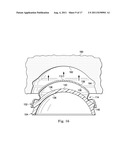 Acetabular Prosthetic Devices and Associated Methods diagram and image