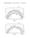 Acetabular Prosthetic Devices and Associated Methods diagram and image