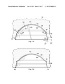 Acetabular Prosthetic Devices and Associated Methods diagram and image