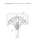 Acetabular Prosthetic Devices and Associated Methods diagram and image