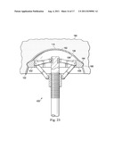 Acetabular Prosthetic Devices and Associated Methods diagram and image