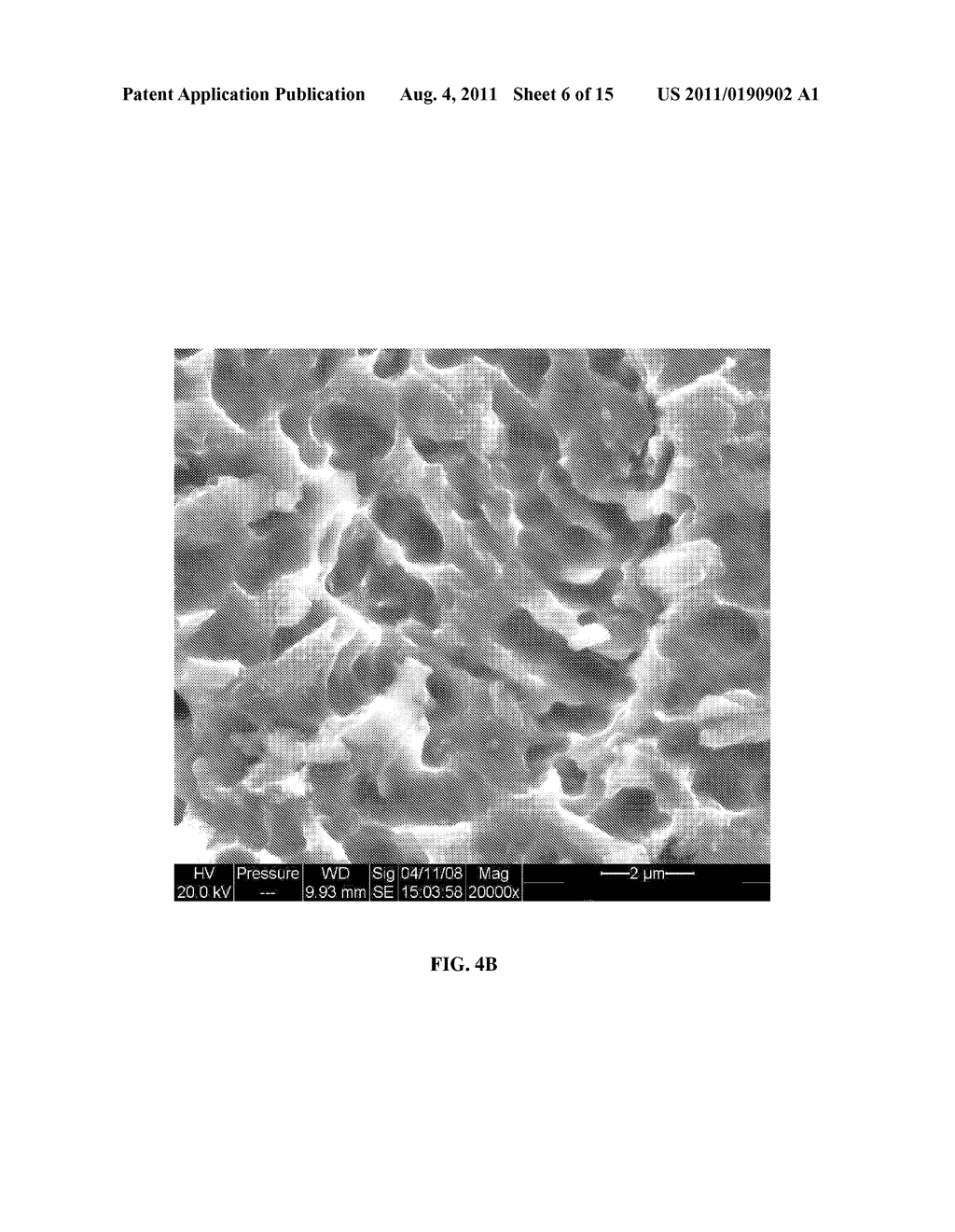 METHODS AND DEVICES FOR IMPLANTS WITH IMPROVED CEMENT ADHESION - diagram, schematic, and image 07