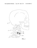 CONTINUOUS PHASE COMPOSITE FOR MUSCULOSKELETAL REPAIR diagram and image