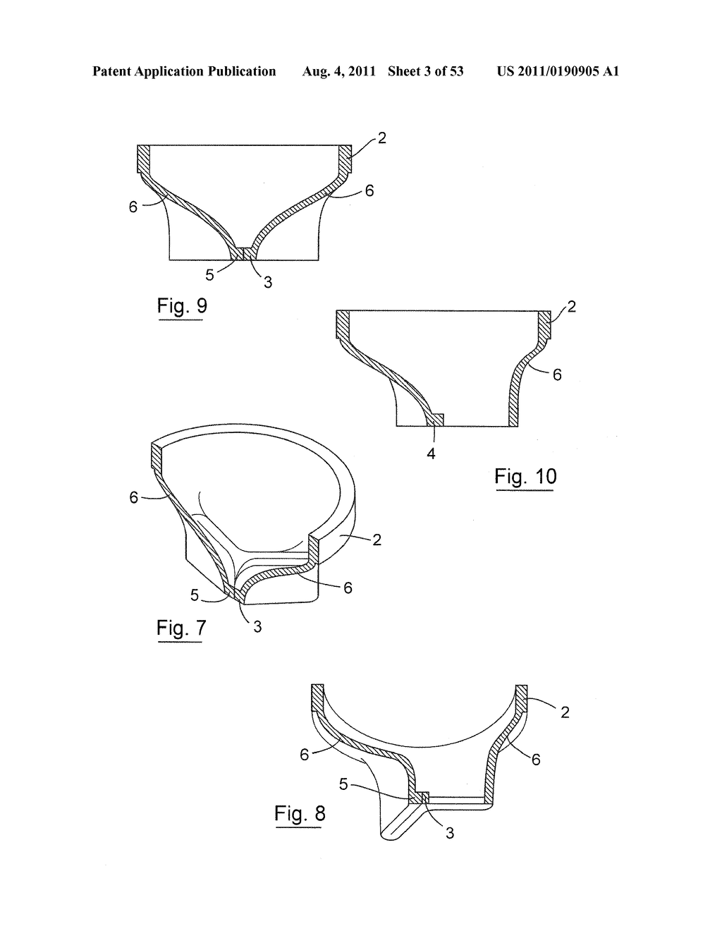 GASTROINTESTINAL IMPLANT - diagram, schematic, and image 04