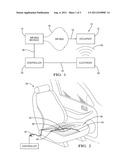 OCCUPANT DETECTION SYSTEM AND METHOD diagram and image