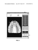 Dental Crowding Analysis Tool diagram and image