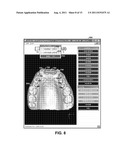 Dental Crowding Analysis Tool diagram and image