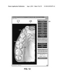 Dental Crowding Analysis Tool diagram and image