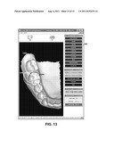 Dental Crowding Analysis Tool diagram and image