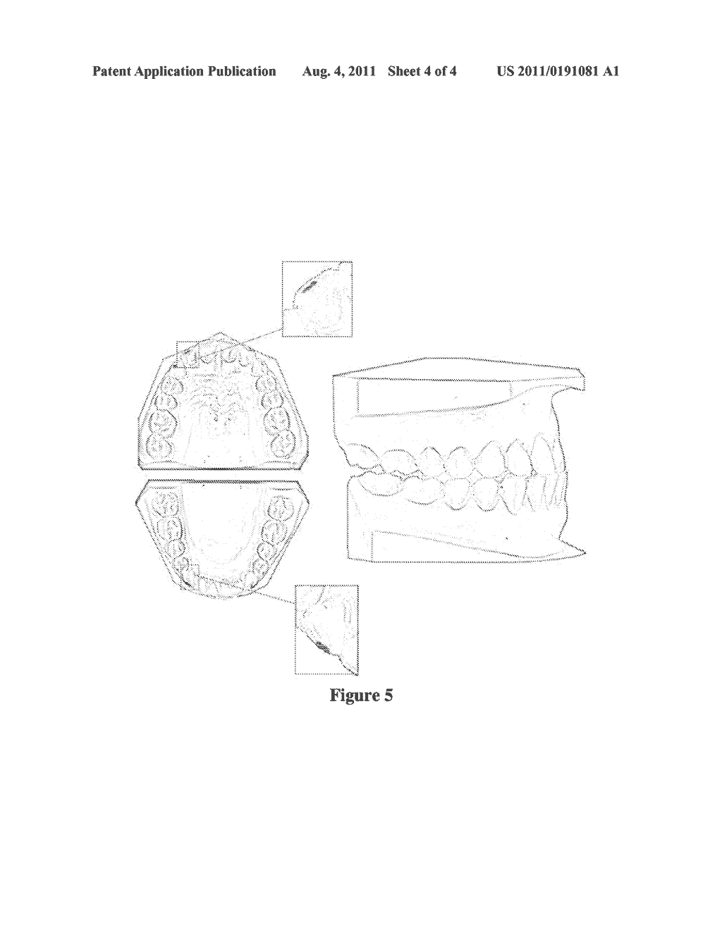 METHOD TO DETERMINE THE IMPACT OF A PROPOSED DENTAL MODIFICATION ON THE     TEMPOROMANDIBULAR JOINT - diagram, schematic, and image 05