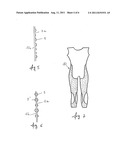 GARMENT SERVING TO COMBAT CELLULITE AND/OR VENOUS AND LYMPHATIC     INSUFFICIENCY diagram and image