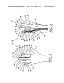 SURGICAL GLOVE SYSTEM diagram and image