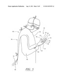 SURGICAL GLOVE SYSTEM diagram and image