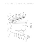 SURGICAL GLOVE SYSTEM diagram and image