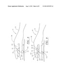 SURGICAL GLOVE SYSTEM diagram and image