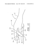 SURGICAL GLOVE SYSTEM diagram and image