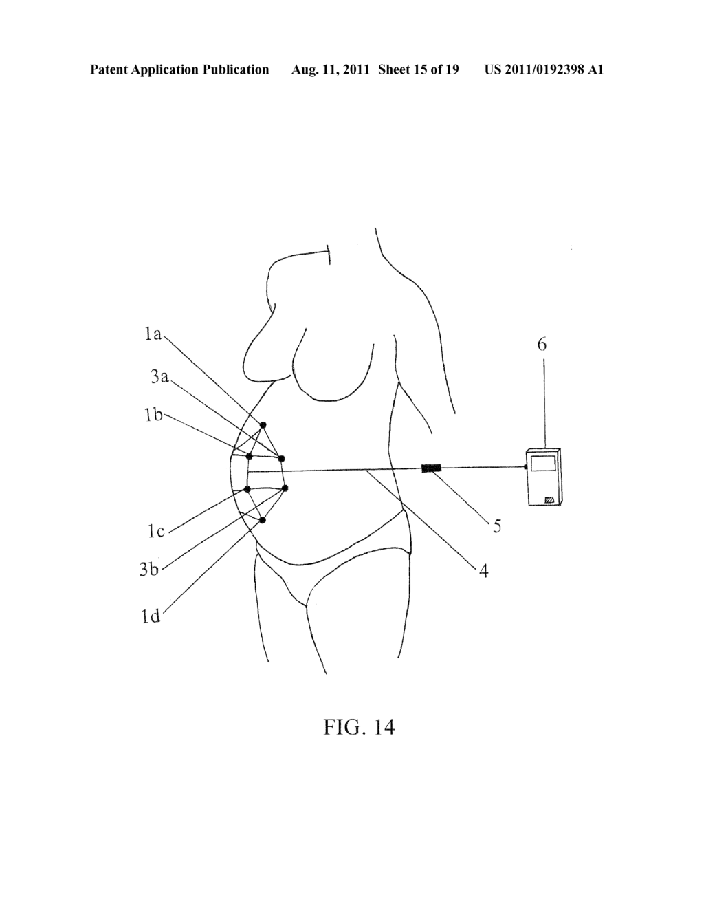 OBSTETRIC ANALGESIA SYSTEM - diagram, schematic, and image 16