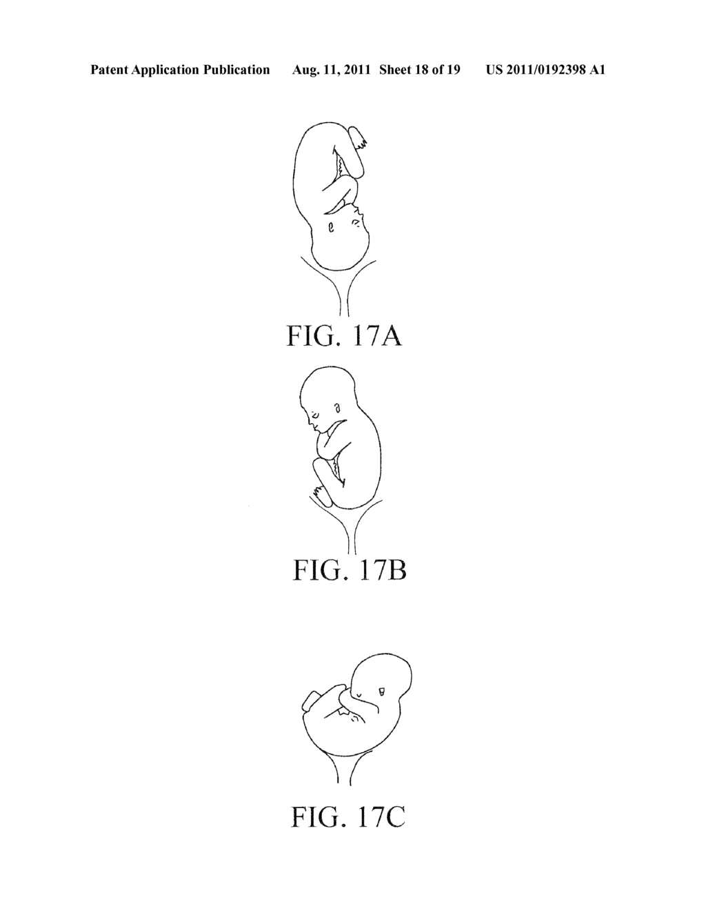 OBSTETRIC ANALGESIA SYSTEM - diagram, schematic, and image 19