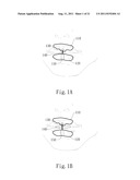 AUTOMATED NEGATIVE PRESSURE ORAL APPARATUS diagram and image