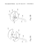 AUTOMATED NEGATIVE PRESSURE ORAL APPARATUS diagram and image