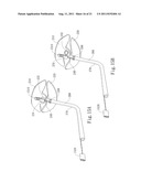 AUTOMATED NEGATIVE PRESSURE ORAL APPARATUS diagram and image